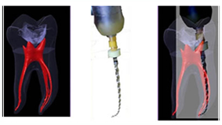 Imagen Endodoncia