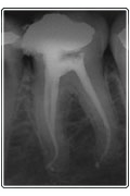 Imagen Endodoncia