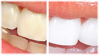 Imagen Estética Dental